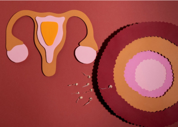 Are Uterine Fibroids Genetic? Understanding the Role of Genetics in Fibroid Development